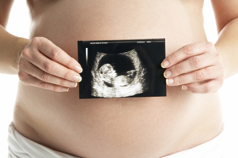 2173782-detail-of-pregnant-woman-holding-ultrasound-scan